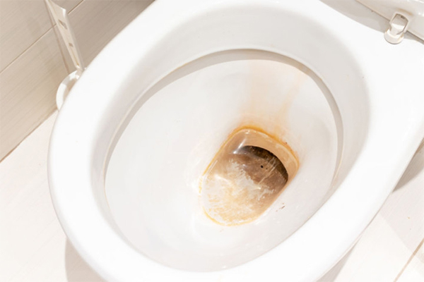 Mảng ố vàng sinh ra do không vệ sinh thường xuyên